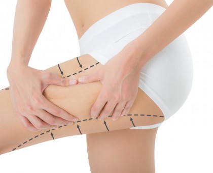 Maigrir – Nos astuces pour perdre sa culotte de cheval