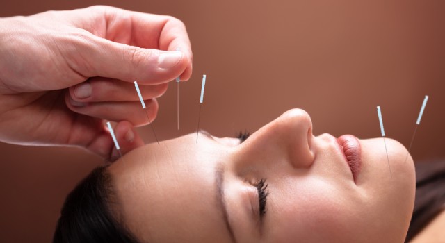 Tout ce qu’il faut savoir sur l’acupuncture