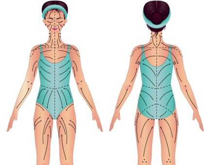 Tout savoir sur le drainage lymphatique