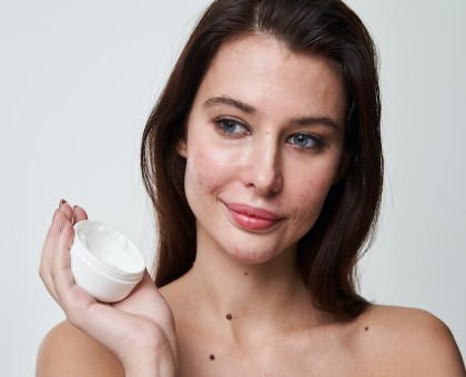 Les pathologies de l’acné chez les femmes et leurs causes