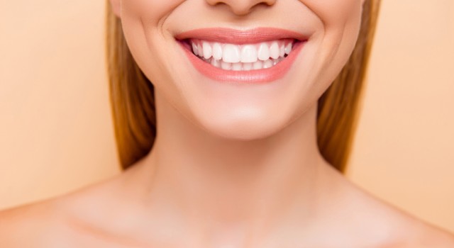 5 raisons de choisir l'implant dentaire