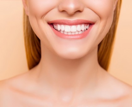 5 raisons de choisir l'implant dentaire