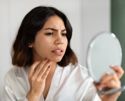 Comment lutter contre la peau terne en hiver : Conseils de pro