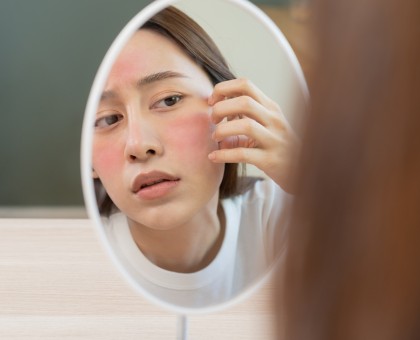 Comment prendre soin de sa peau sensible naturellement ?