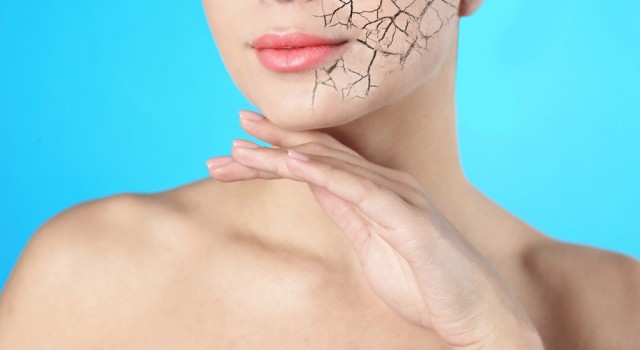 Comment prendre soin de sa peau sèche naturellement ?