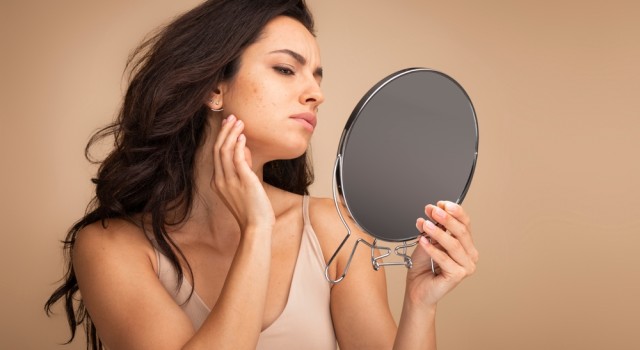 Comment prendre soin de sa peau terne naturellement ?