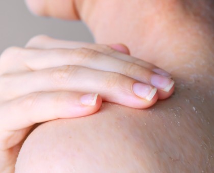 Comment prendre soin de sa peau déshydratée naturellement ?