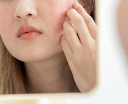 Peau sensible : les erreurs à éviter dans votre routine