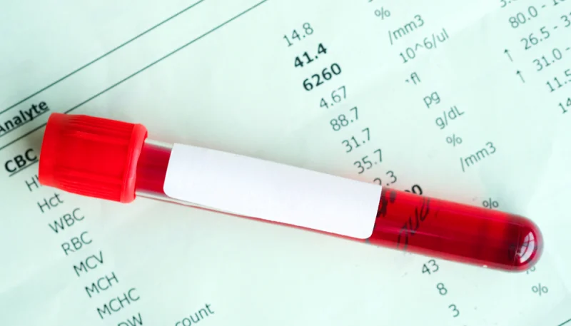 Examens médicaux : comprendre les résultats