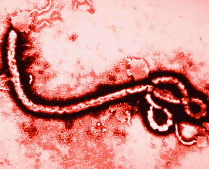 Fièvre Ebola : un virus contagieux et mortel qui inquiète les autorités