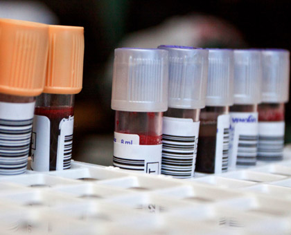 Hépatite B : une maladie qui peut finir en cirrhose ou cancer du foie