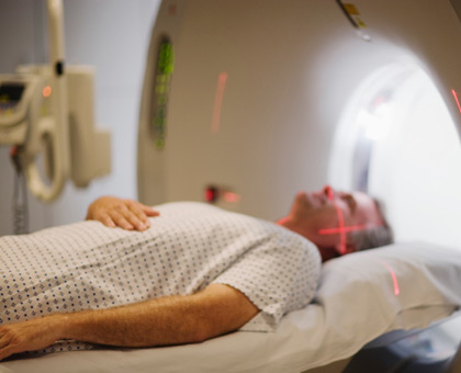 La sclérose en plaques