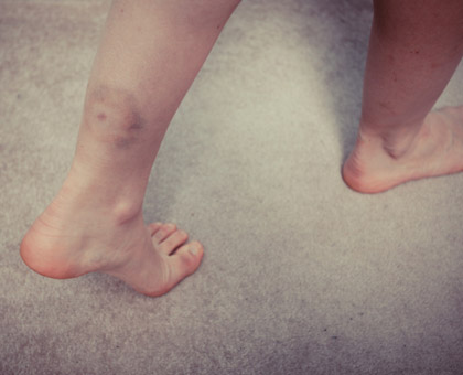 Coups, bosses : ayez les bons réflexes !