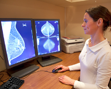Le cholestérol augmente les risques de cancer du sein