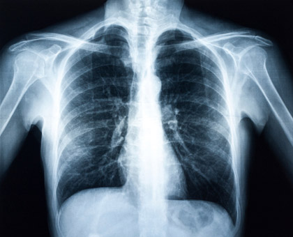 Une radiographie, pour quoi faire ?