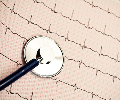 Qu’est-ce qu’un électrocardiogramme ?