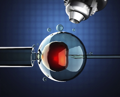 La procréation assistée : une autre manière de faire des bébés