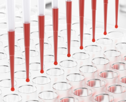 Virus Ebola : première victime française