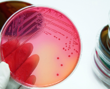 La coproculture ou analyse des selles