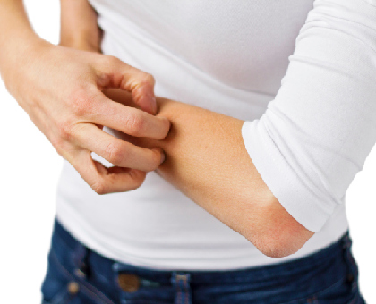 Une urticaire est-elle toujours d’origine allergique ?