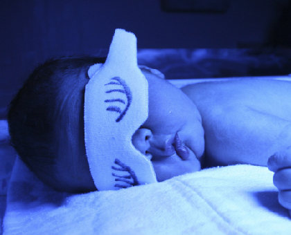 La jaunisse du nourrisson, est-ce grave ?