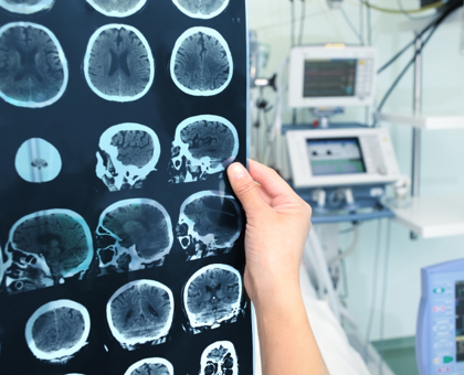 Que se passe-t-il dans le cerveau des pédophiles ?