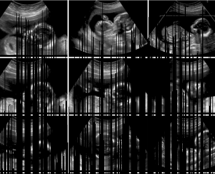 La grossesse - semaine 22