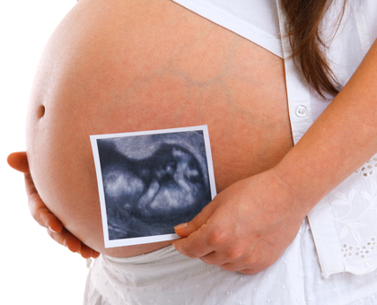 Que faut-il savoir de la troisième échographie ?