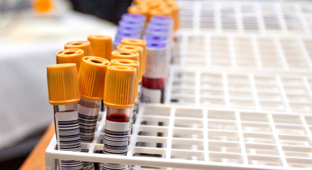 Thyroïde : que dose-t-on dans le bilan sanguin ?