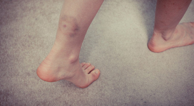 Coups, bosses : ayez les bons réflexes !