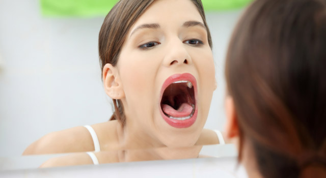 Comment traiter les aphtes ?