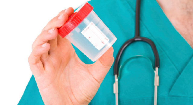 L’ECBU, un examen qui permet de détecter les infections urinaires