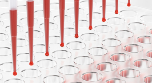 Virus Ebola : première victime française