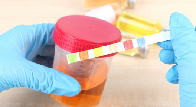 Cancer du col de l’utérus : bientôt des tests urinaires