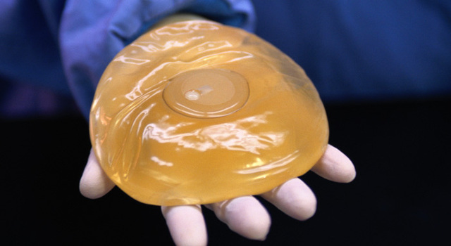 Les prothèses mammaires seraient-elles à l’origine d’un nouveau cancer ?