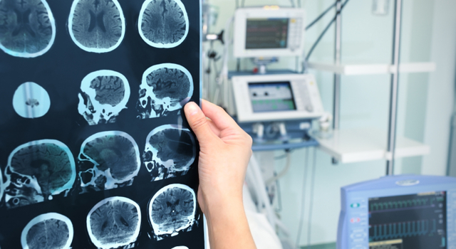 Que se passe-t-il dans le cerveau des pédophiles ?