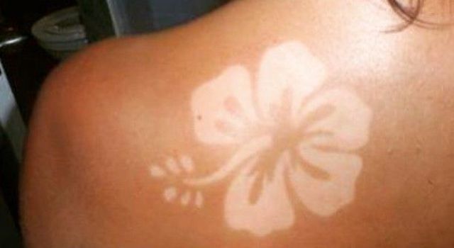 Le Sunburn art : la tendance dangereuse de l’été