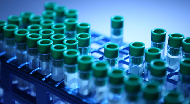 Le danger du cholestérol : mythe ou réalité ? Une enquête santé à ne pas rater sur France 5