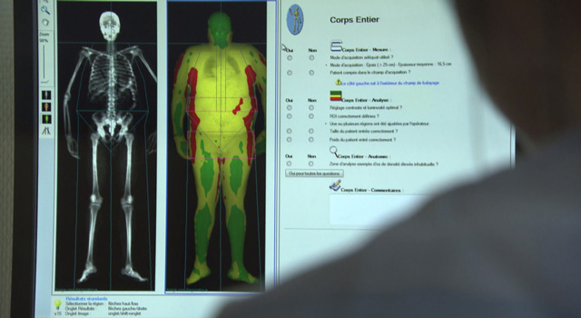 Enquête de santé : 