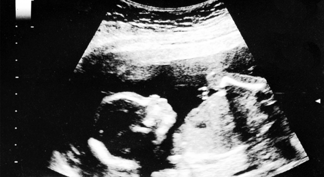 La grossesse - semaine 21