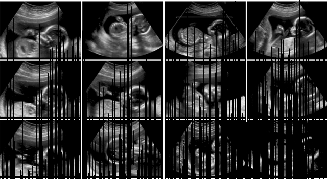 La grossesse - semaine 22