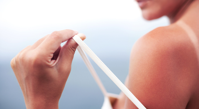 SOS coups de soleil : comment les apaiser naturellement ?